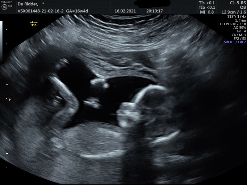 mamashuisje.nl 17 weken zwanger echo